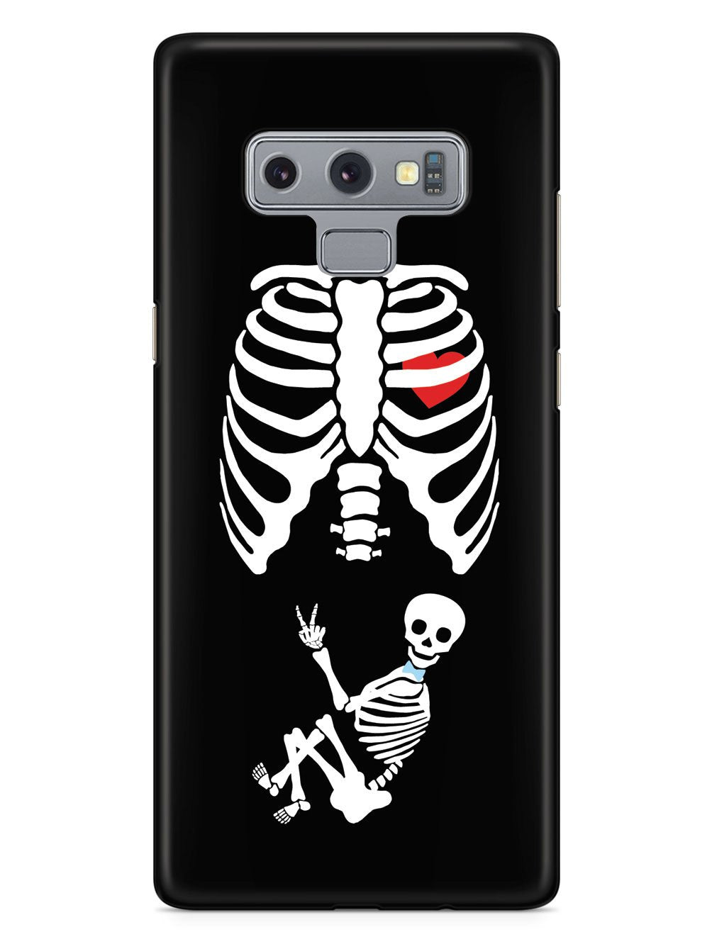 Expecting Skeleton Mom - Boy Case