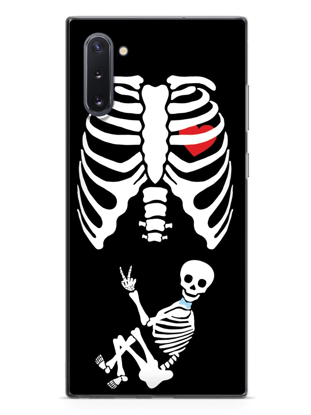 Expecting Skeleton Mom - Boy Case
