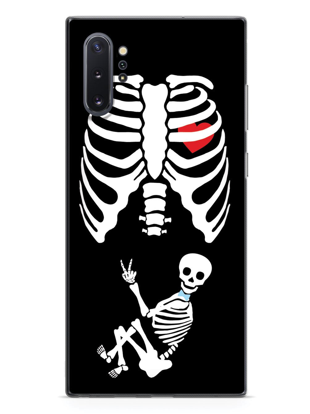 Expecting Skeleton Mom - Boy Case