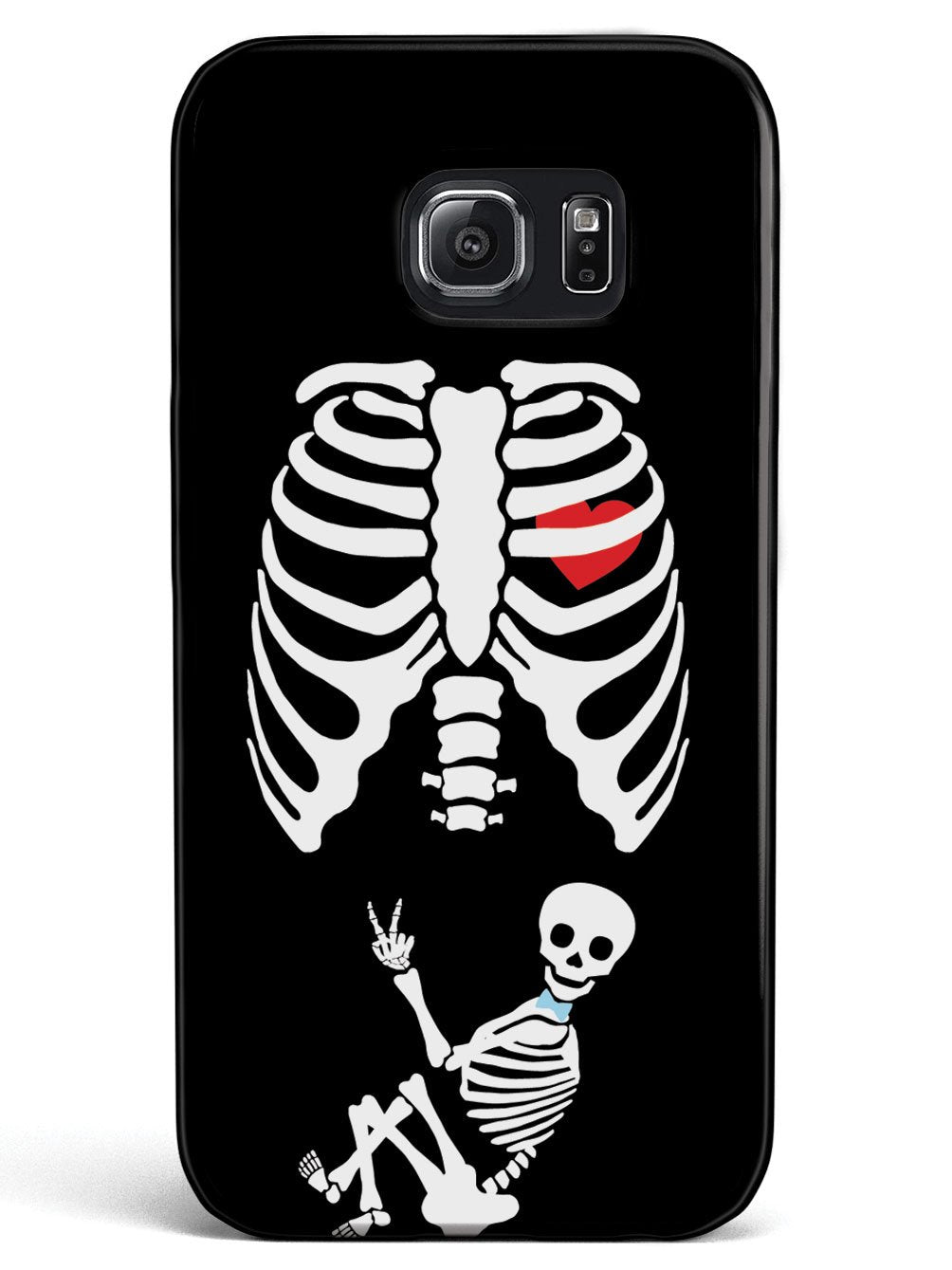 Expecting Skeleton Mom - Boy Case
