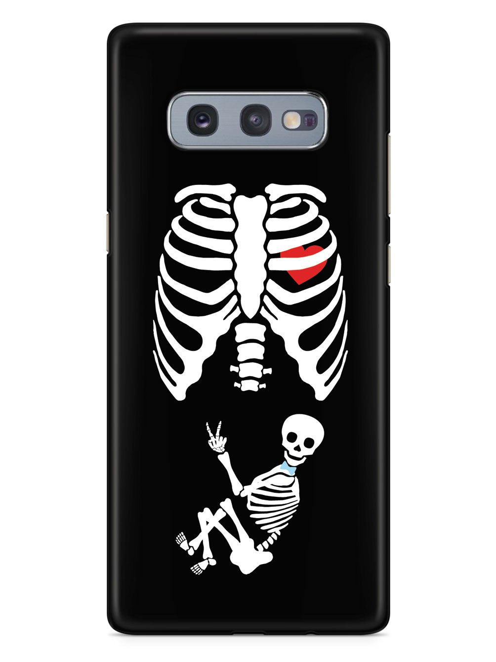 Expecting Skeleton Mom - Boy Case