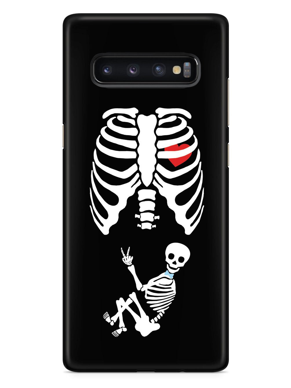 Expecting Skeleton Mom - Boy Case