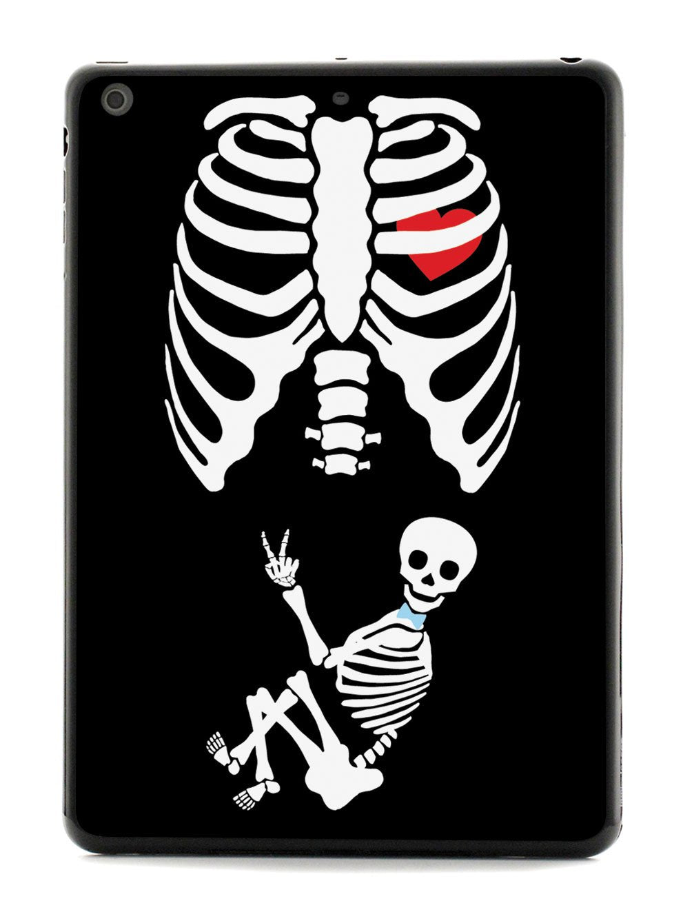 Expecting Skeleton Mom - Boy Case