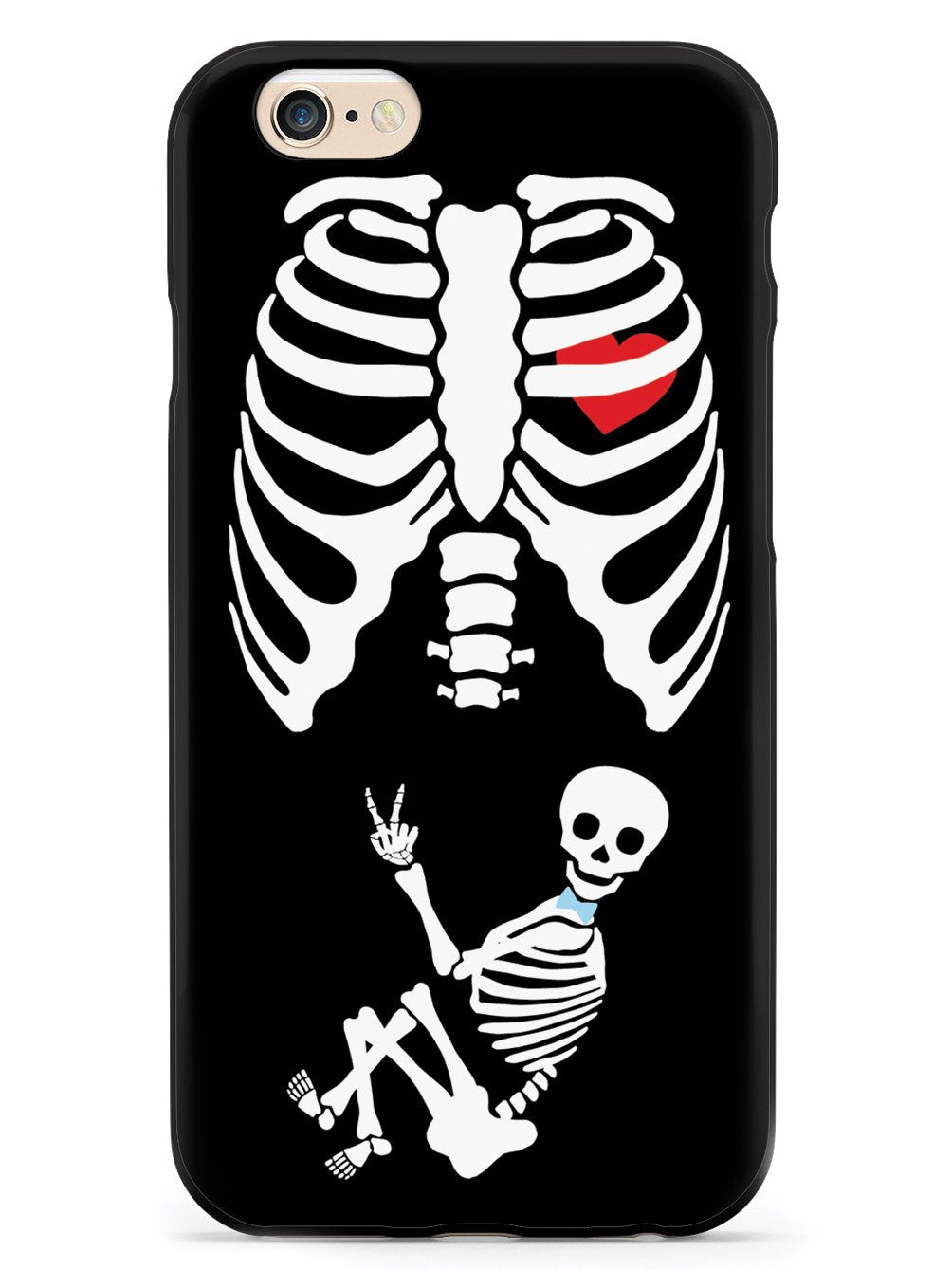 Expecting Skeleton Mom - Boy Case