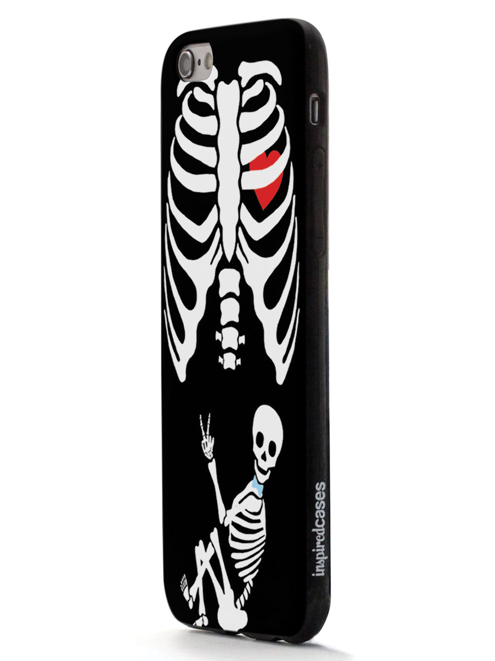 Expecting Skeleton Mom - Boy Case