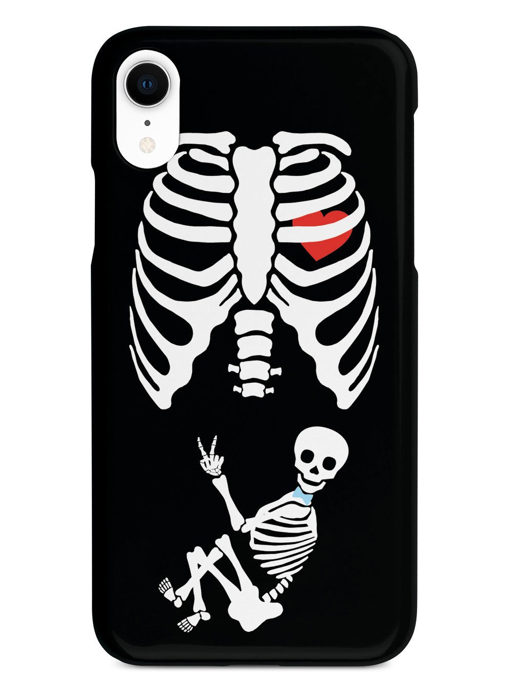 Expecting Skeleton Mom - Boy Case