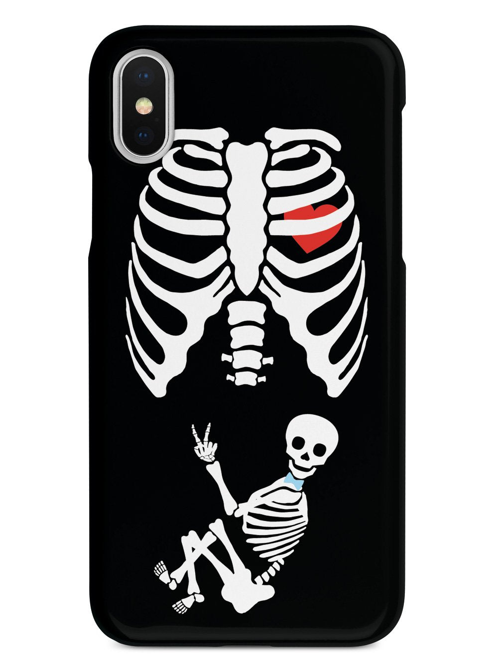 Expecting Skeleton Mom - Boy Case