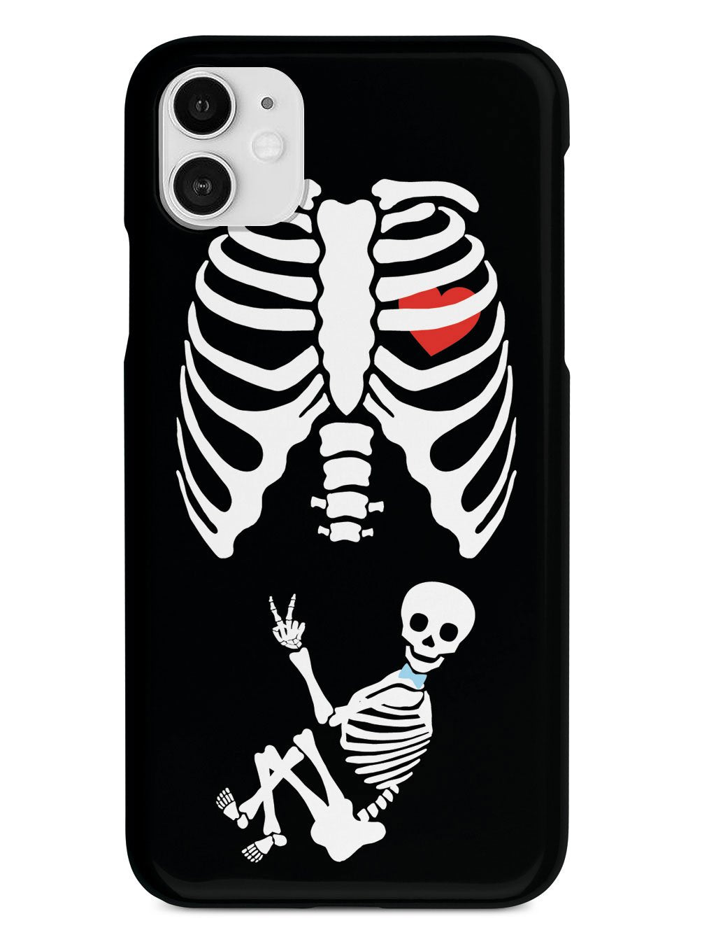 Expecting Skeleton Mom - Boy Case