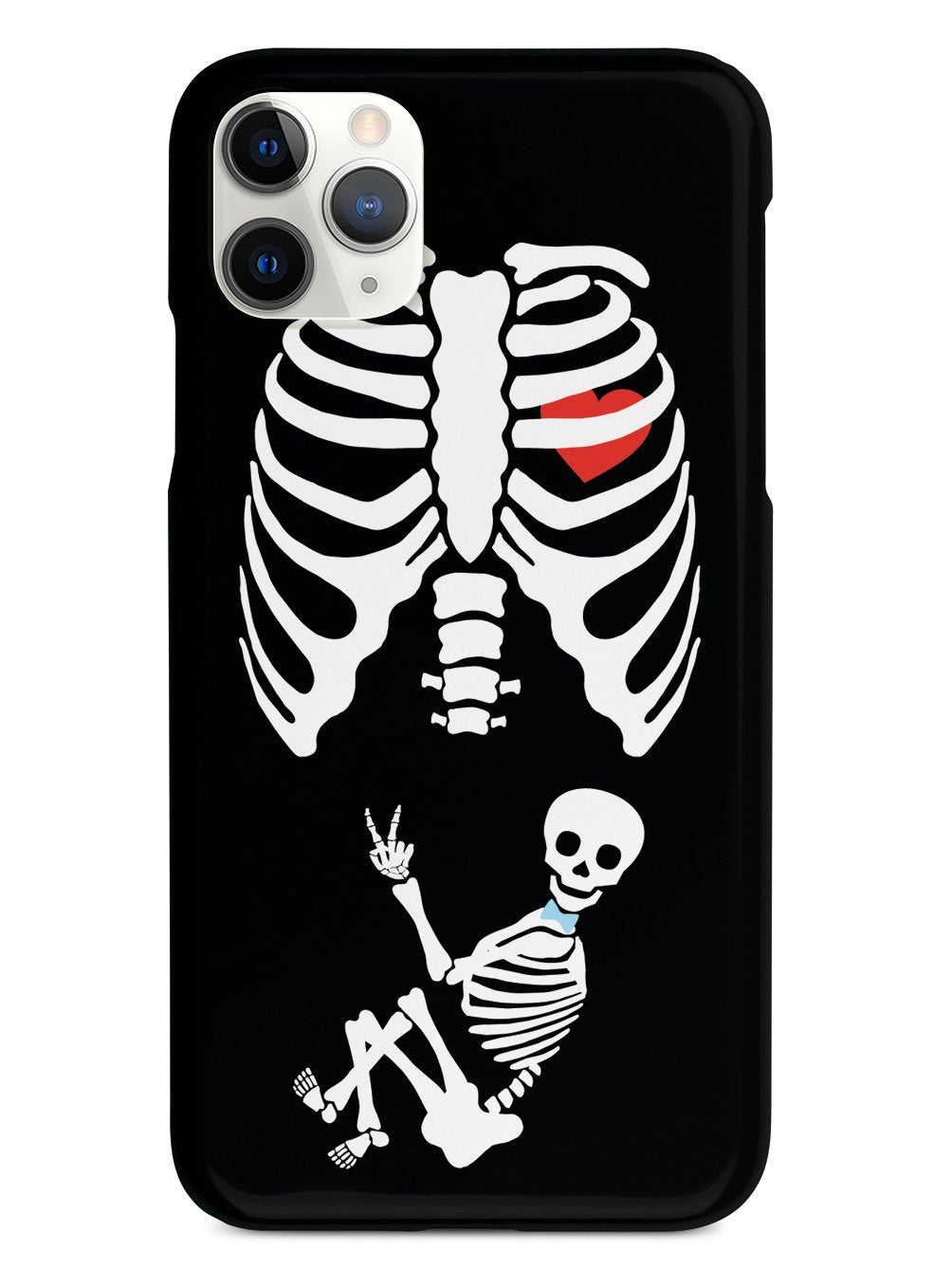 Expecting Skeleton Mom - Boy Case