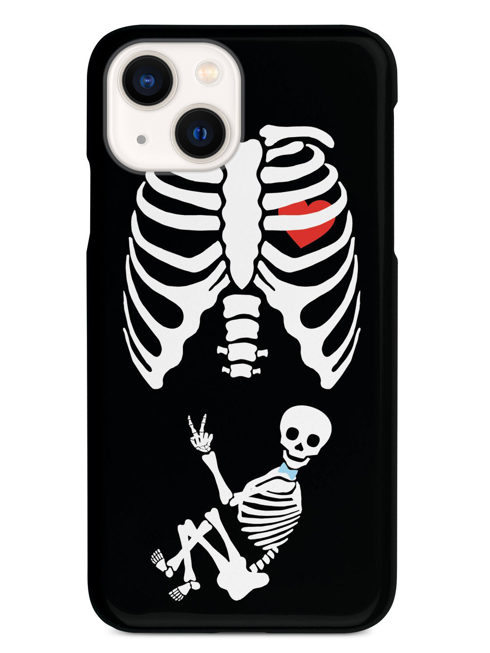 Expecting Skeleton Mom - Boy Case